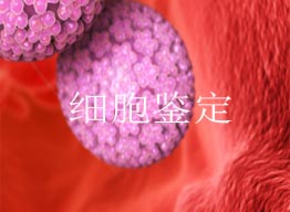為什么要進(jìn)行細(xì)胞鑒定？